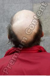 Hair Man White Underweight Bald